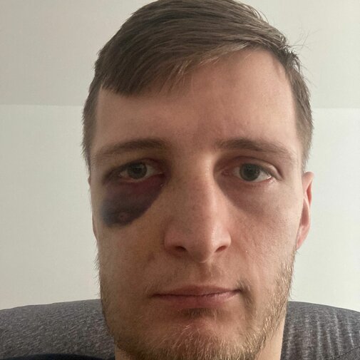 Honza Štěrba mimo hru Honza Štěrba mimo hru