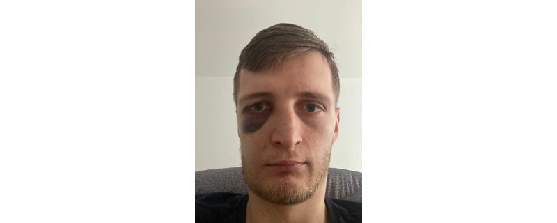 Honza Štěrba mimo hru Honza Štěrba mimo hru
